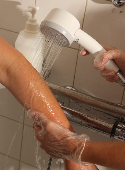 Poin-of-use Legionella filter in hospital